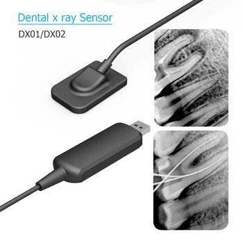 Dental x-ray Senzor DynImage Hiter Prenos Digitalnih Intraoral Sistem Znotraj Ustni s Programsko opremo, 3m Kabel Jasno Sliko DynImage